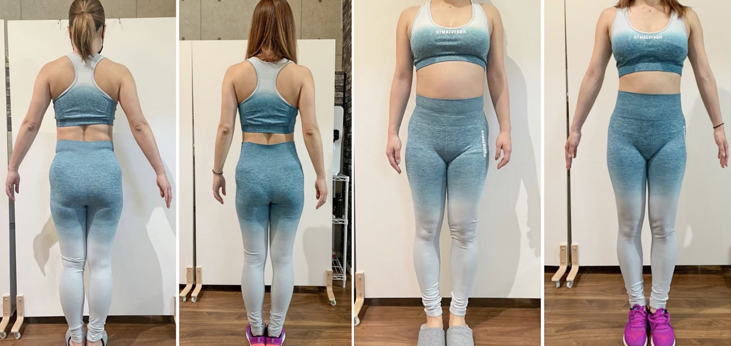 Before After